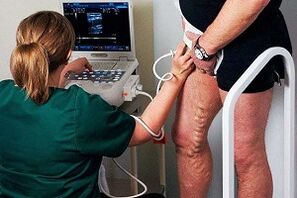 Diagnoseoptionen für Krampfadern an den Beinen